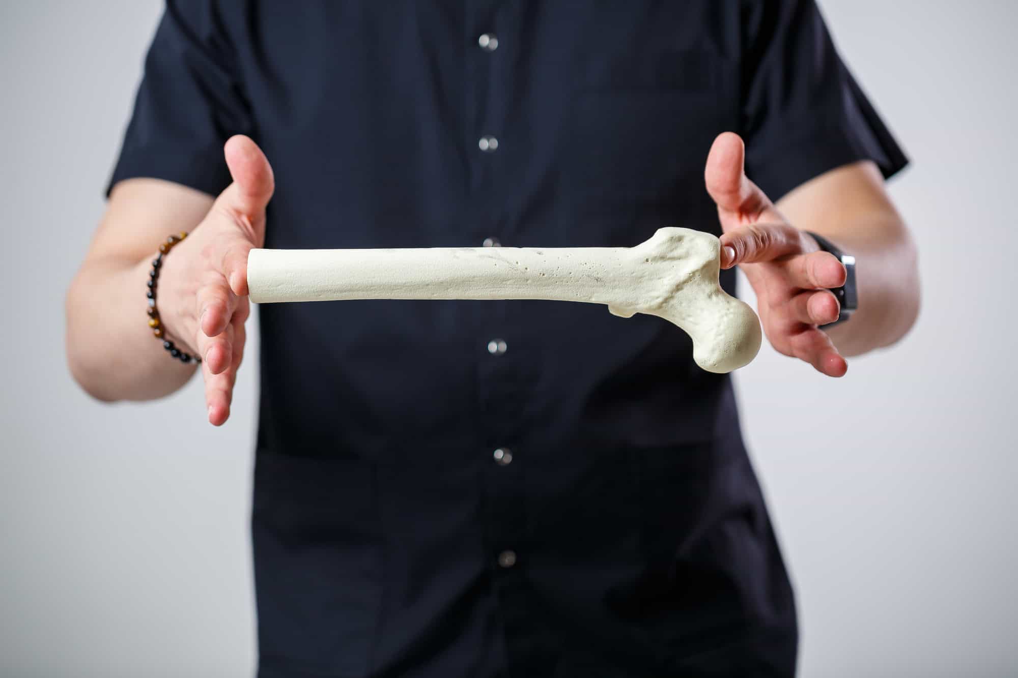 A person holding a human femur bone model, symbolising HueLight's focus on bone health and regeneration.